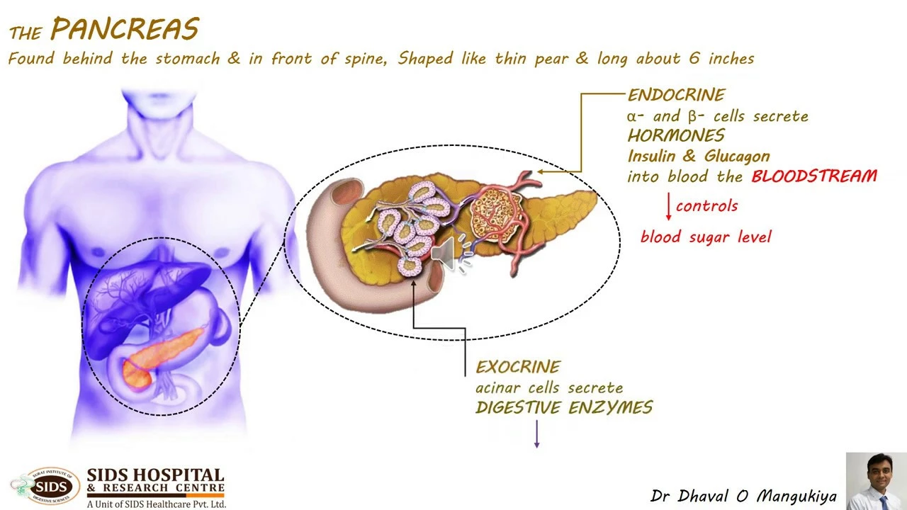 The Connection between Pancreatitis and Pancreatic Cancer